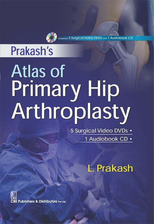 Prakash Atlas of Primary Hip Arthroplasty