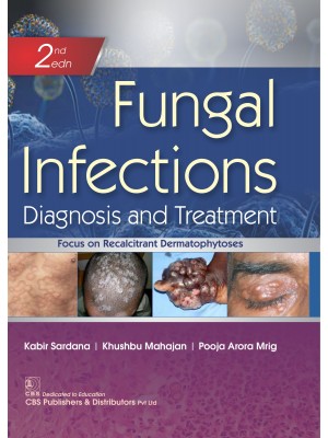 Fungal Infections Diagnosis and Treatment