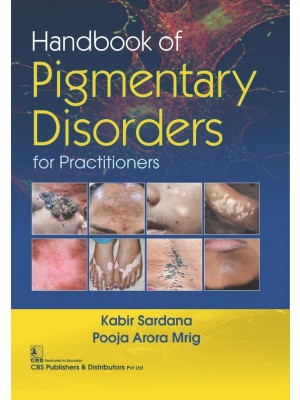 Handbook of Pigmentary Disorders For Practitioners