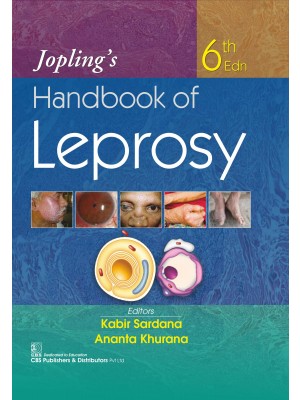 Jopling’s Handbook of Leprosy  | 9789389688115 | Kabir Sardana | Ananta Khurana