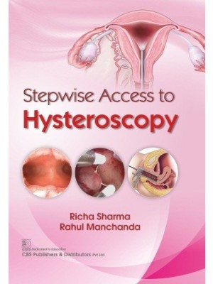 Stepwise Access to Hysteroscopy
