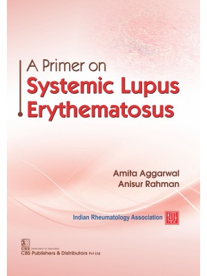 A PRIMER ON SYSTEMIC LUPUS ERYTHEMATOSUS (PB 2021)