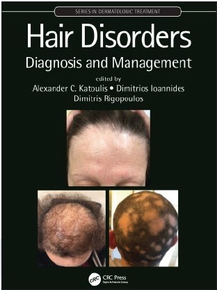 Hair Disorders Diagnosis and Management