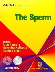 The Sperm
