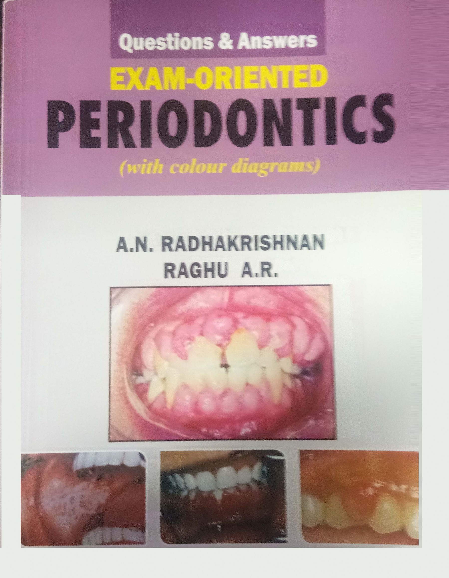 Questions & Answers Exam-Oriented Periodontics (With Colour Diagrams)