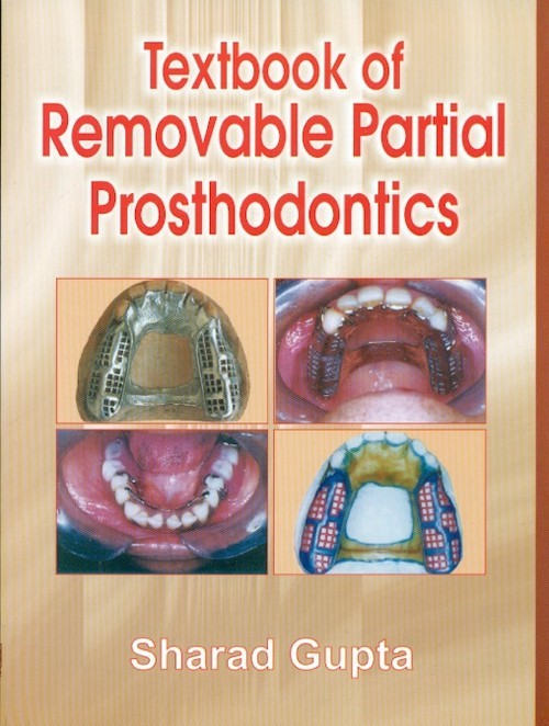 Textbook Of Removable Partial Prosthodontics