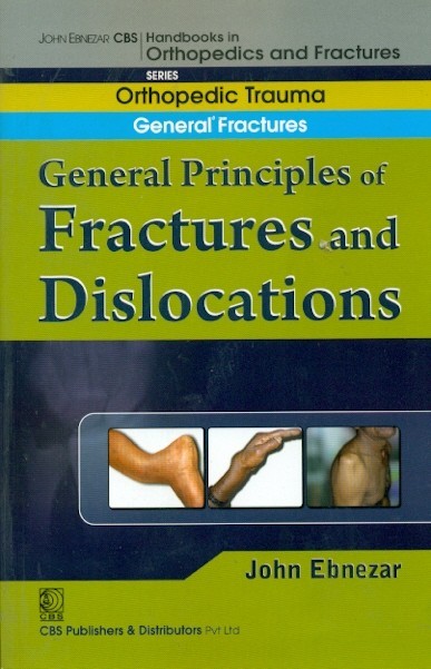 General Principles Of Fractures And Dislocations (Handbook Of Orthopedics And Fractures Series, Vol. 1: Orthopedic Trauma General Fractures)