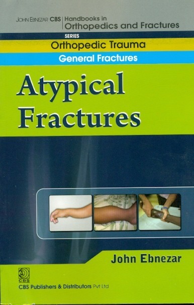 A Typical Fractures (Handbook In Orthopedics And Fractures Vol.4 - Orthopedic Trauma General Fractures)