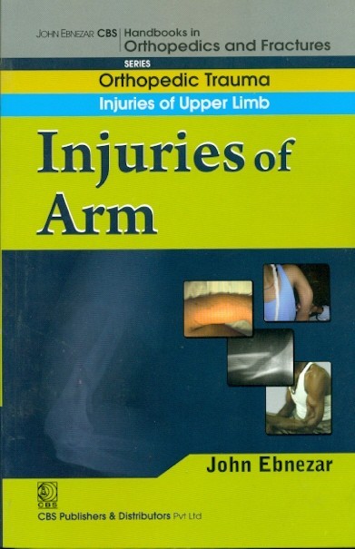 Injuries Of Arm ((Handbook In Orthopedics And Fractures Series, Vol. 6 - Orthopedic Trauma Injuries Of Upper Limb)