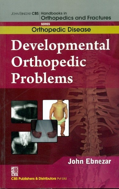 Developmental Orthopedic Problems (Handbooks In Orthopedics And Fractures Series, Vol. 29: Orthopedic Disease)