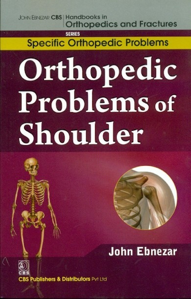 Orthopedic Problems Of Shoulder  (Handbooks In Orthopedics And Fractures Series, Vol.43: Specific Orthpedic Problems)