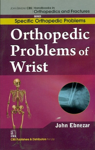 Orthopedic Problems Of Wrist (Handbooks In Orthopedics And Fractures Series, Vol 46: Specific Orthopedic Problems)