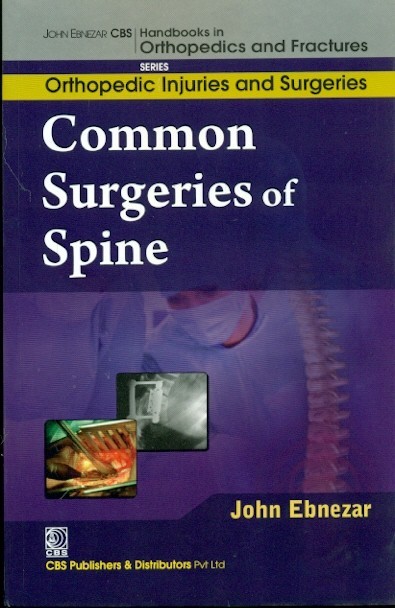 Common Surgeries Of Spine (Handbooks In Orthopedics And Fractures Series, Vol. 59-Orthopedic Injuries And Surgeries)