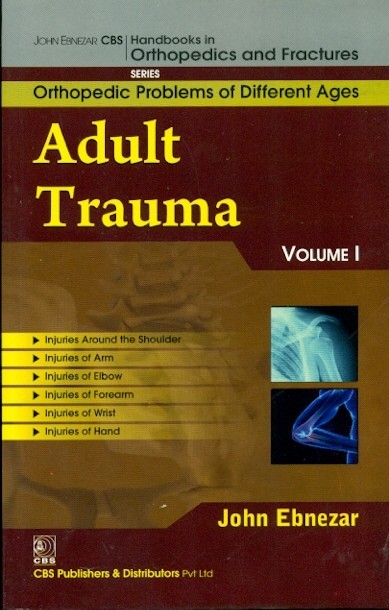 Adult Trauma Vol. 1  (Handbooks In Orthopedics And Fractures Series, Vol. 75 Orthopedic Problems Of Different Ages)