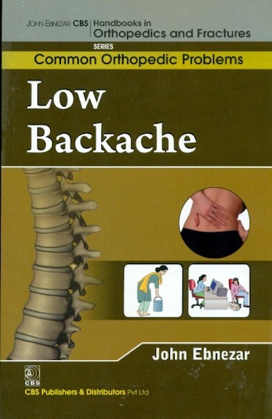 Low Backache (Handbooks In Orthopedics And Fractures Series, Vol. 86  Common Orthopedic Problems  )