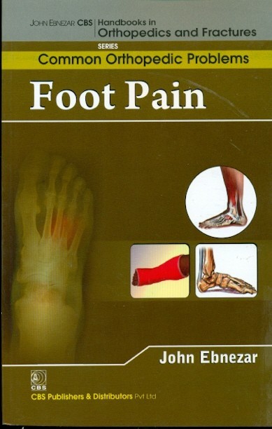 Foot Pain (Handbooks In Orthopedics And Fractures Series, Vol. 91- Common Orthopedic Problems)