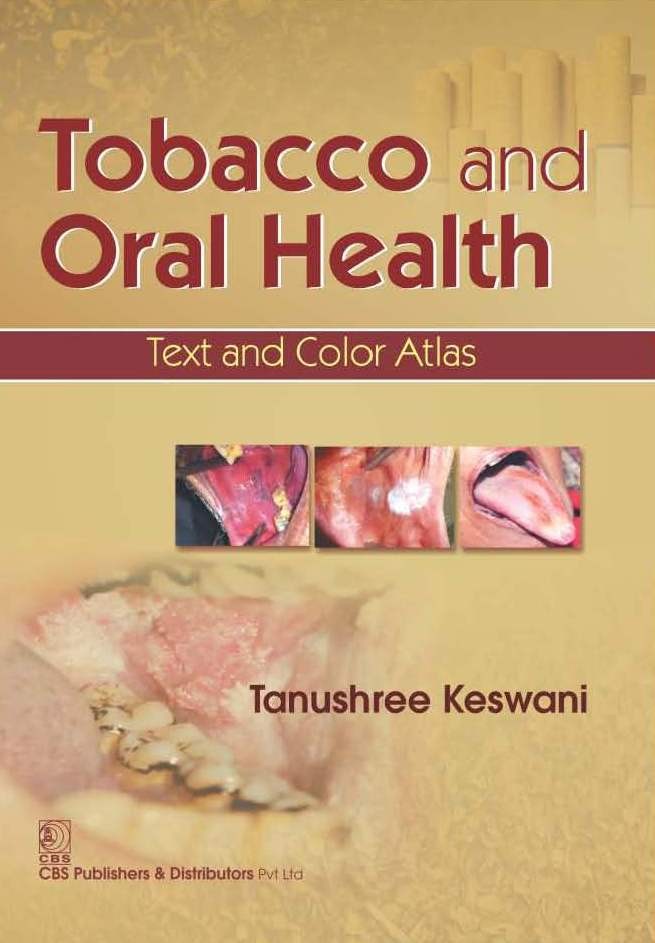 Tobacco And Oral Health Text And Color Atlas (Pb 2016)