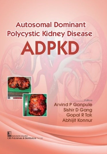 Autosomal Dominant Polycystic Kidney Disease ADPKD