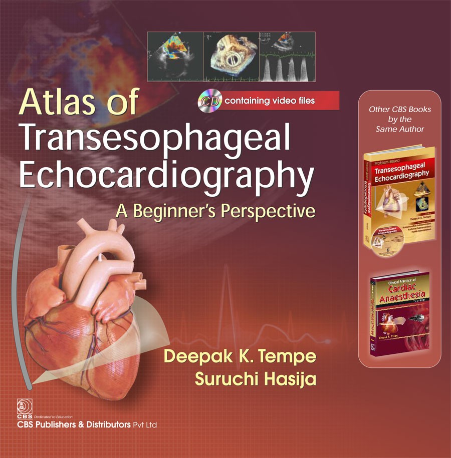 Atlas of Transesophageal Echocardiography a Beginner’s Perspective Included CD containing video files 