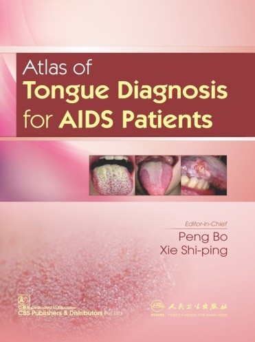 Atlas of Tongue Diagnosis for AIDS Patients (CBS reprint)