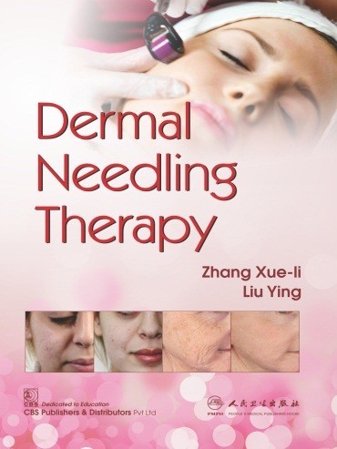 Dermal Needling Therapy (CBS reprint)