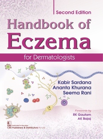 Handbook of Eczema  for Dermatologists