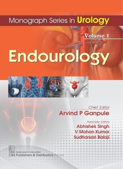 Monograph Series in Urology  Volume 1: Endourology
