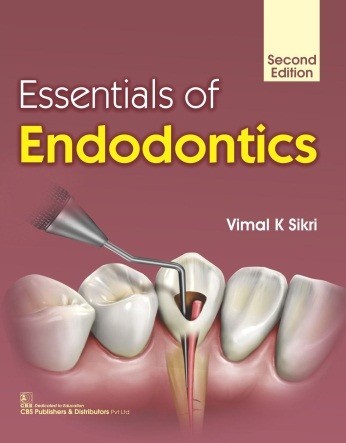 Essentials of Endodontics, 2/e