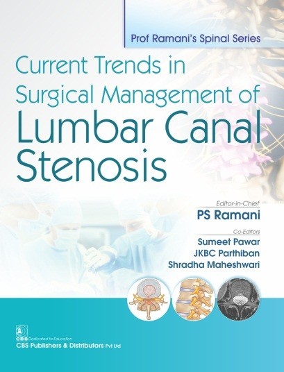 Ramani’s Spinal Series  Current Trends in Surgical Management of Lumbar Canal Stenosis