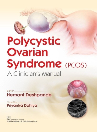 Polycystic Ovarian Syndrome (PCOS) A Clinician’s Manual