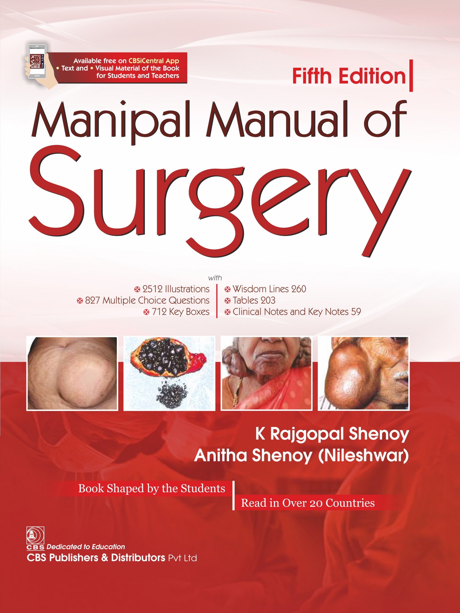 Manipal Manual of Surgery by Shenoy 5th Edition