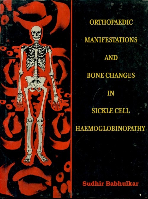 Orthopaedic Manifestations & Bone Changes In Sickle Cell Haemoglobinopathy