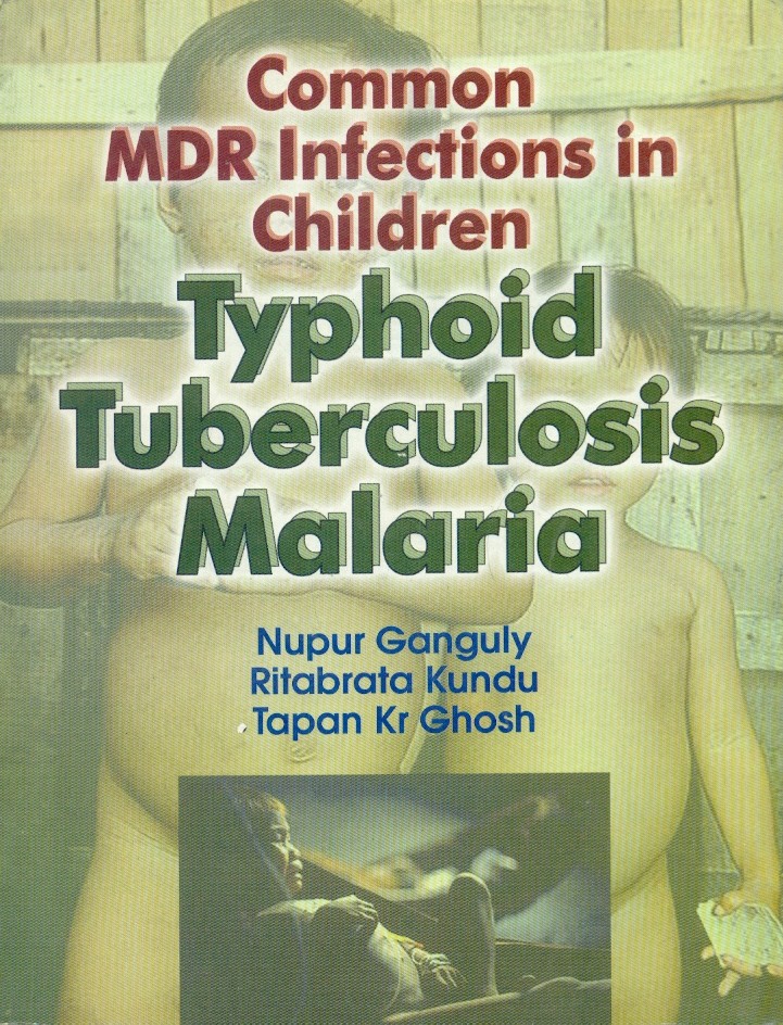 Common Mdr Infections In Children Typhoid Tuberculosis Malaria