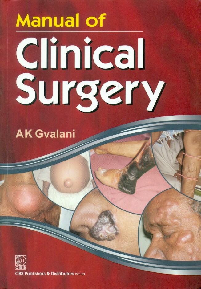 Manual Of Clinical Surgery (Pb-2014)