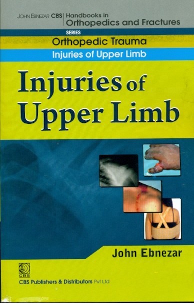 Injuries Of Upper Limb  ((Handbook In Orthopedics And Fractures Vol.12 - Orthopedic Trauma Injuries Of Upper Limb)