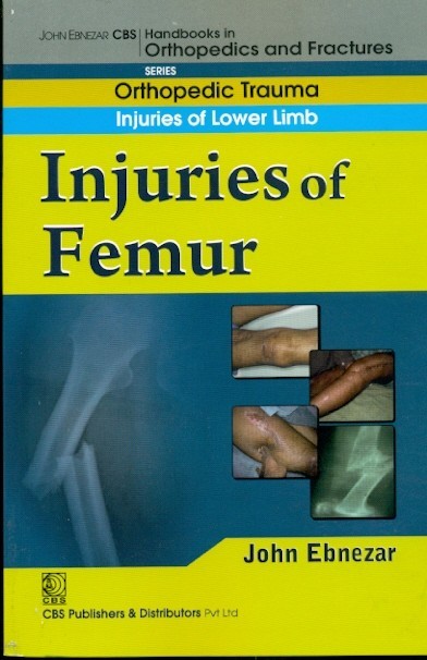 In Juries Of Femur (Handbook In Orthopedics And Fractures Vol.14 - Orthopedic Trauma Injuries Of Lower Limb)