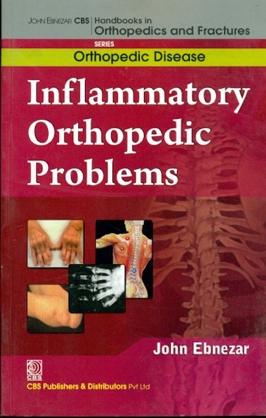 Inflammatory Orthopedic Problems  (Handbooks In Orthopedics And Fractures Series, Vol.34: Orthopedic Disease)