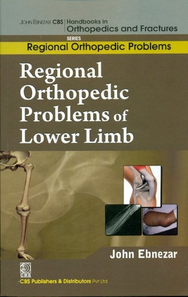 Regional Orthopedic Problems Of Lower Limb (Handbooks In Orthopedics And Fractures Series, Vol. 49: Regional Orthopedic Problems)