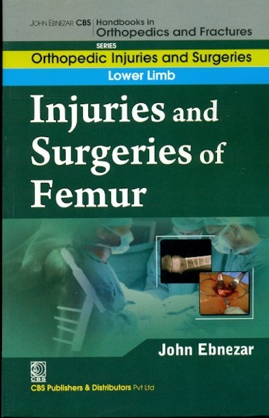 Injuries And Surgeries Of Femur (Handbooks In Orthopedics And Fractures Series, Vol. 56: Lower Limb)