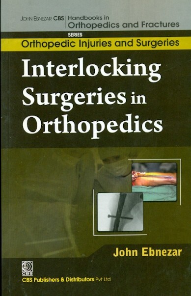 Interlocking Surgeries In Orthopedics (Handbooks In Orthopedics And Fractures Series, Vol. 60-Orthopedic Injuries And Surgeries)