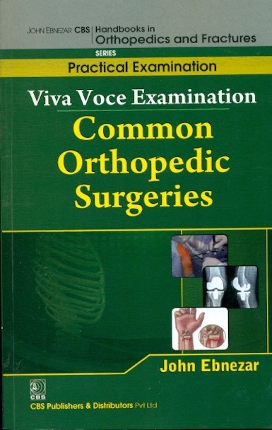 Viva Voce Examination Common Orthopedic Surgeries (Handbooks In Orthopedics And Fractures Series, Vol. 69-Practical Examination)