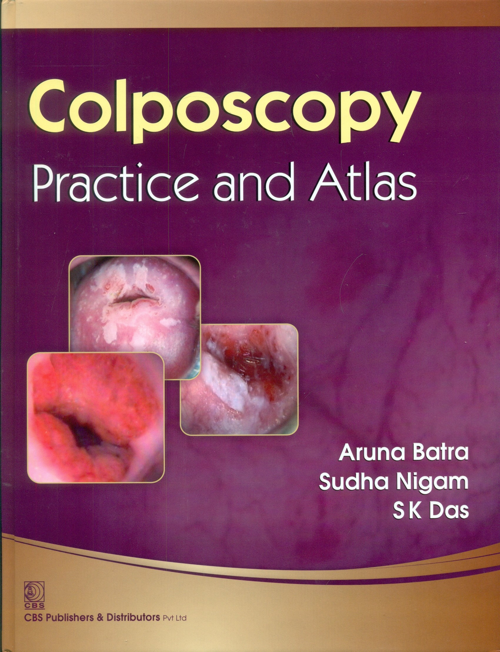 Colposcopy Practice And Atlas (Hb-2014)
