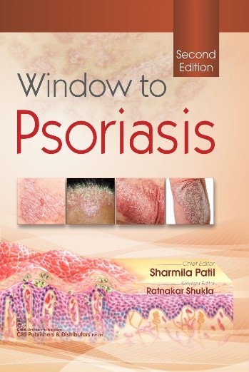 Window to Psoriasis, 2nd Edition