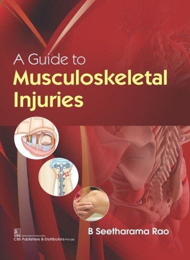 A Guide to Musculoskeletal Injuries