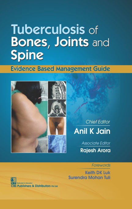 Tuberculosis of Bones, Joints and Spine -  Evidence Based Management Guide