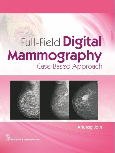 Full-Field Digital Mammography Case-Based Approach