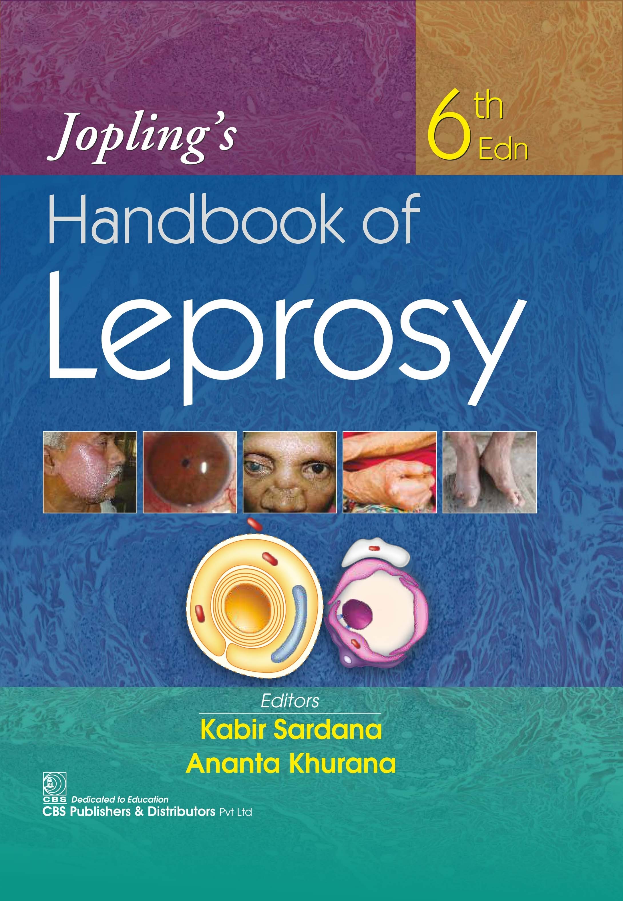 Jopling’s Handbook of Leprosy  | 9789389688115 | Kabir Sardana | Ananta Khurana