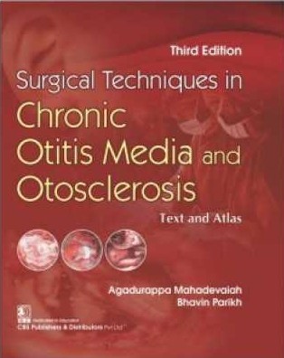 Surgical Techniques In Chronic Otitis Media And Otosclerosis 3rd/2021 By agadurappa mahadevaiah