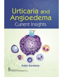 Urticaria and Angioedema Current Insights