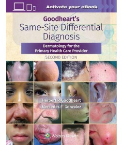 Goodheart's Same-Site Differential Diagnosis Dermatology for the Primary Health Care Provider